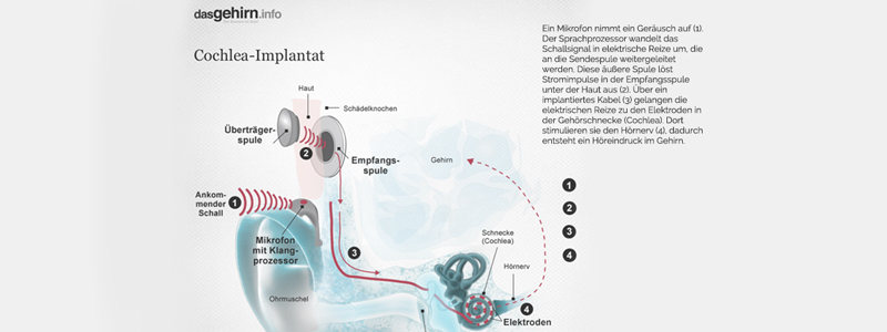 Behandlung von Tinnitus: Endlich wieder Ruhe im Ohr