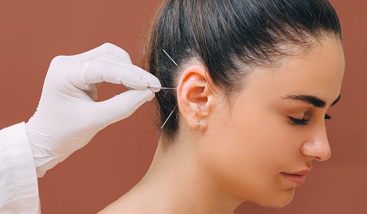 Akupunktur an den Ohren